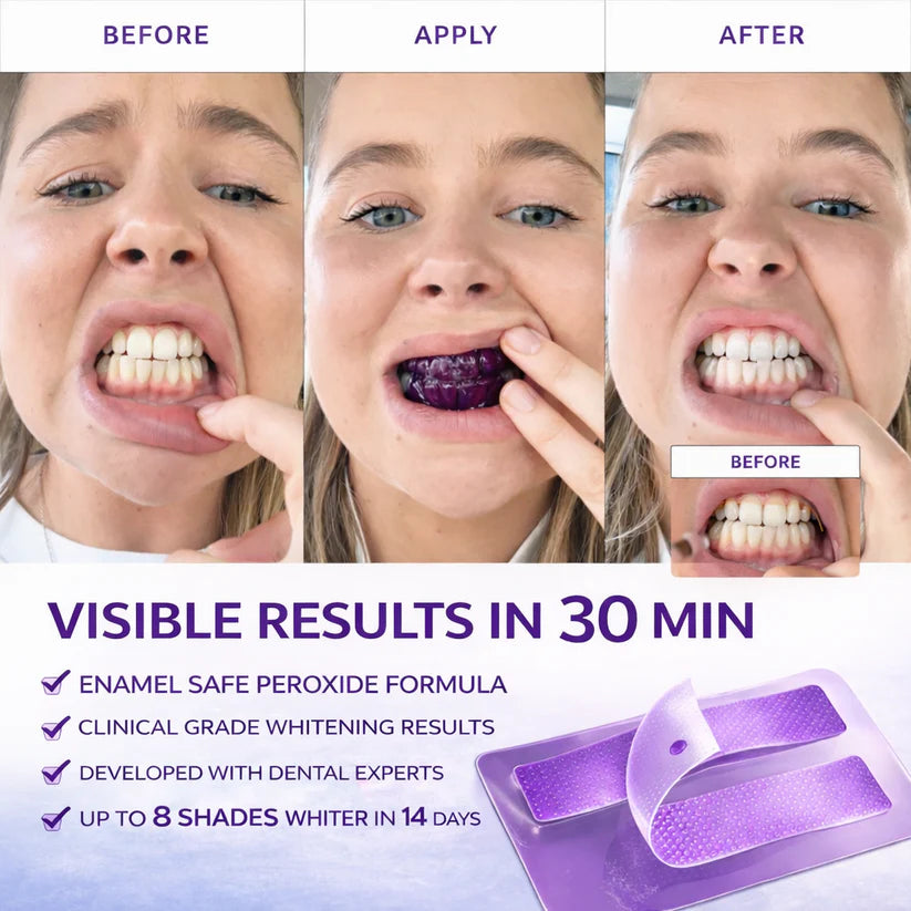 Luvia™ Purple Teeth Whitening Strips (Buy 1 GET 1 FREE)
